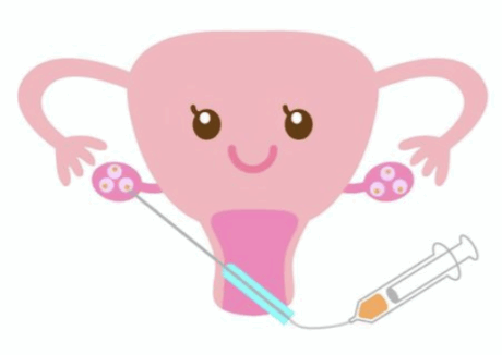 妊活奮闘記③採卵期