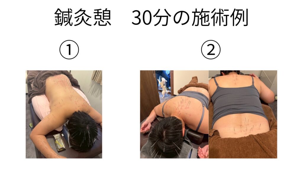 鍼灸憩 ともき先生